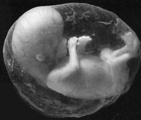 Unborn-Baby.gif